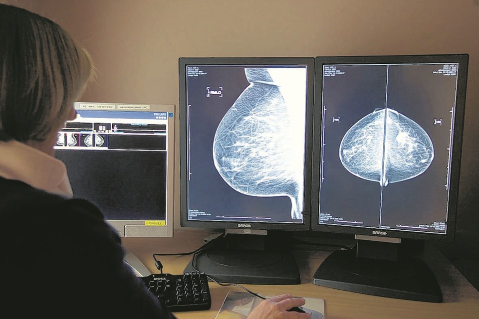 Een radioloog bekijkt digitale rontgenfoto’s van een borst. 
