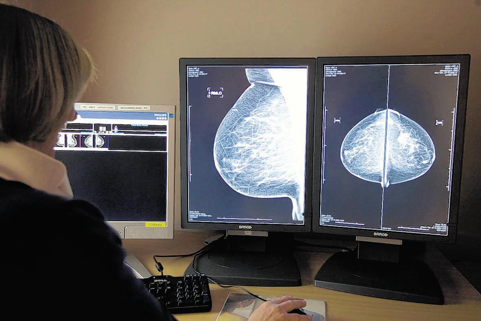 Een radioloog bekijkt borstopnames in Rotterdam.