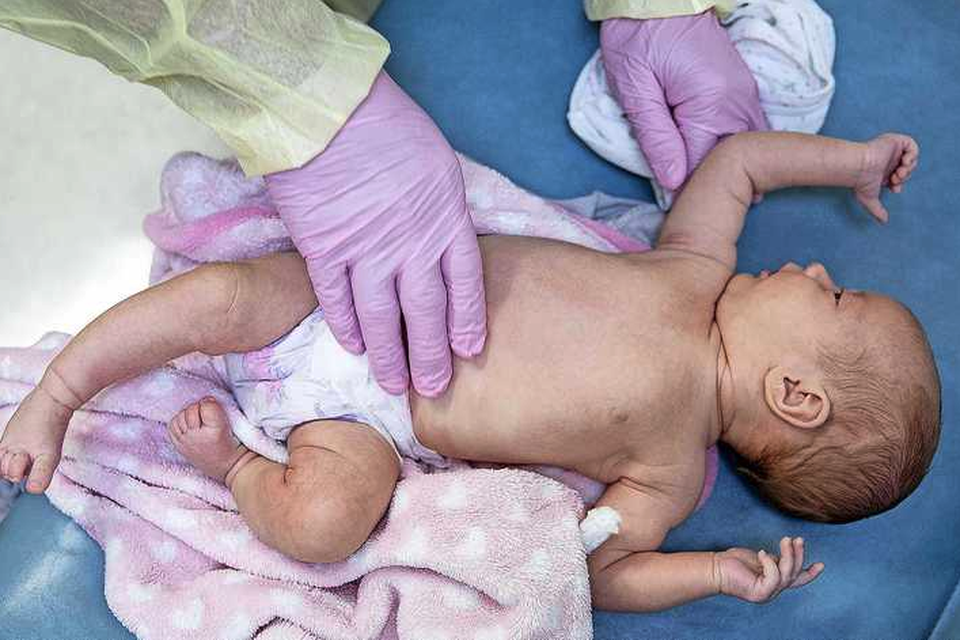 Een arts onderzoekt een baby in een kliniek in de Verenigde Staten op de verschijnselen van het RS-virus. De symptomen zijn kortademigheid en een piepende ademhaling. 