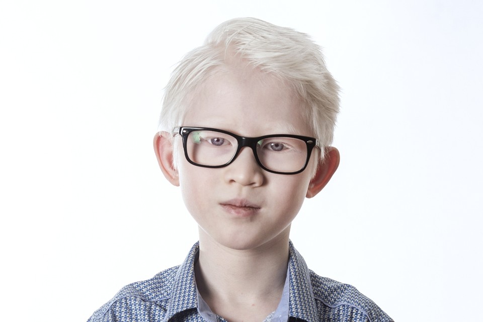 Yun uit Gulpen heeft albinisme, maar dat houdt hem nergens in tegen. „Ik voel me helemaal niet beperkt. 