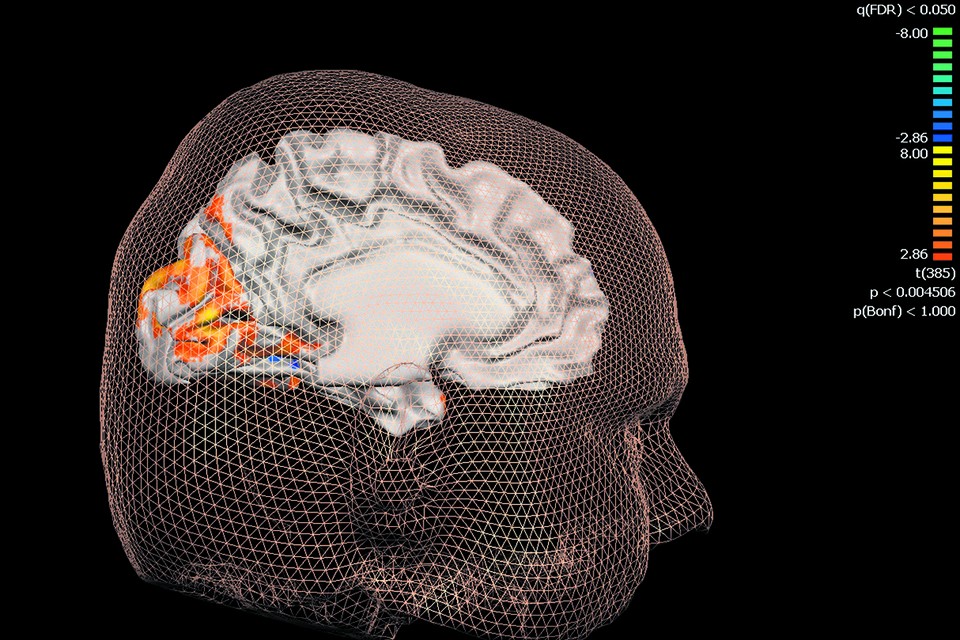 Bij het onderzoek werd hersenactiviteit in kaart gebracht met fMRI-scans