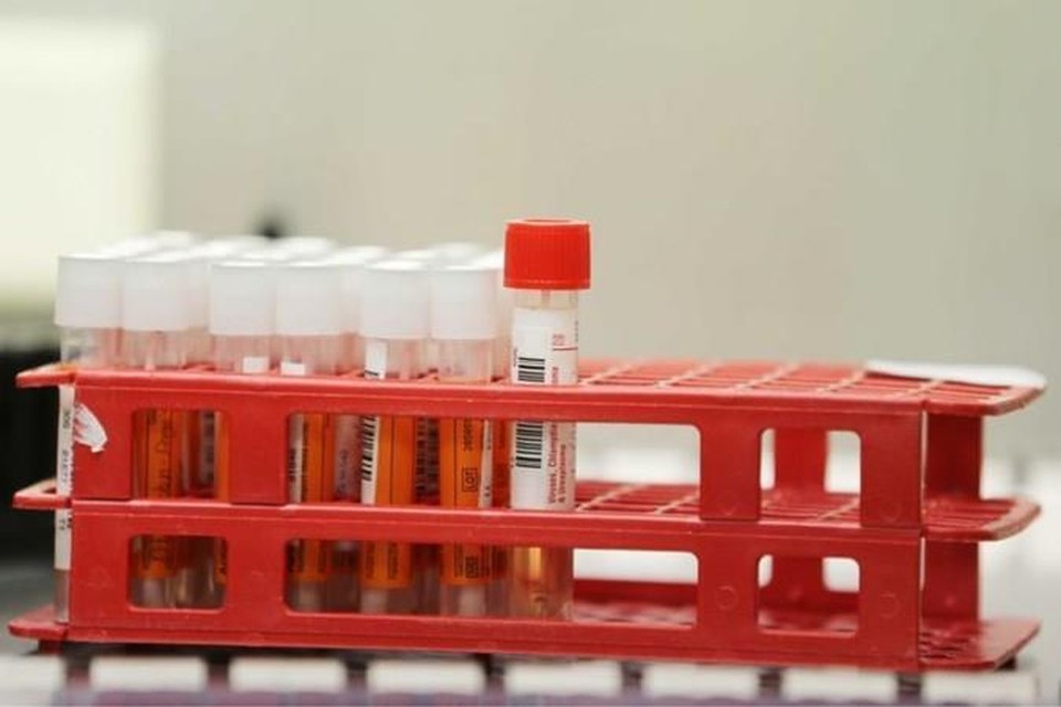 Coronatests in een laboratorium. 